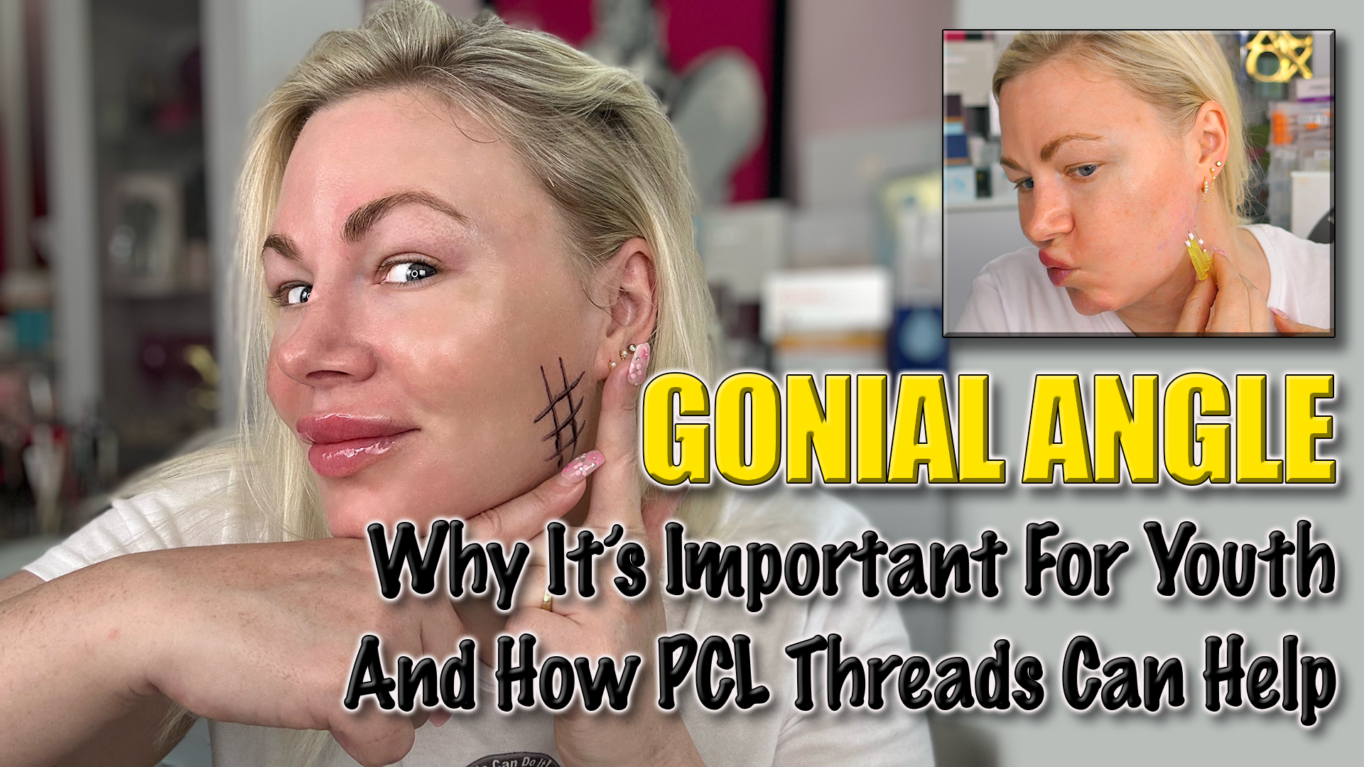 PCL Threads | Cog Threads | Thread Lifts | DIY Threads